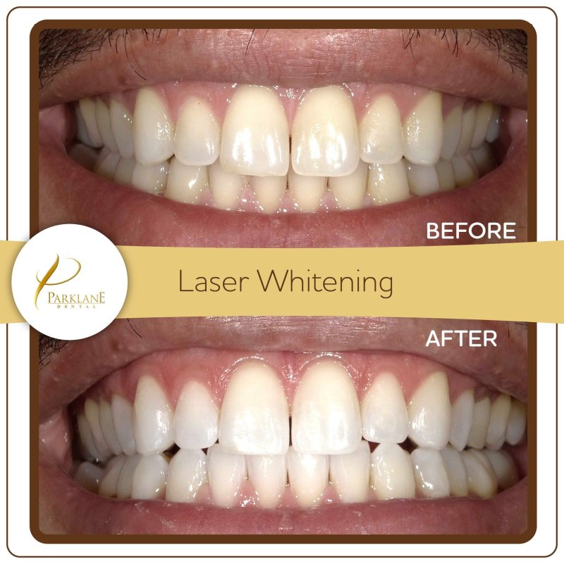 Laser247. Com